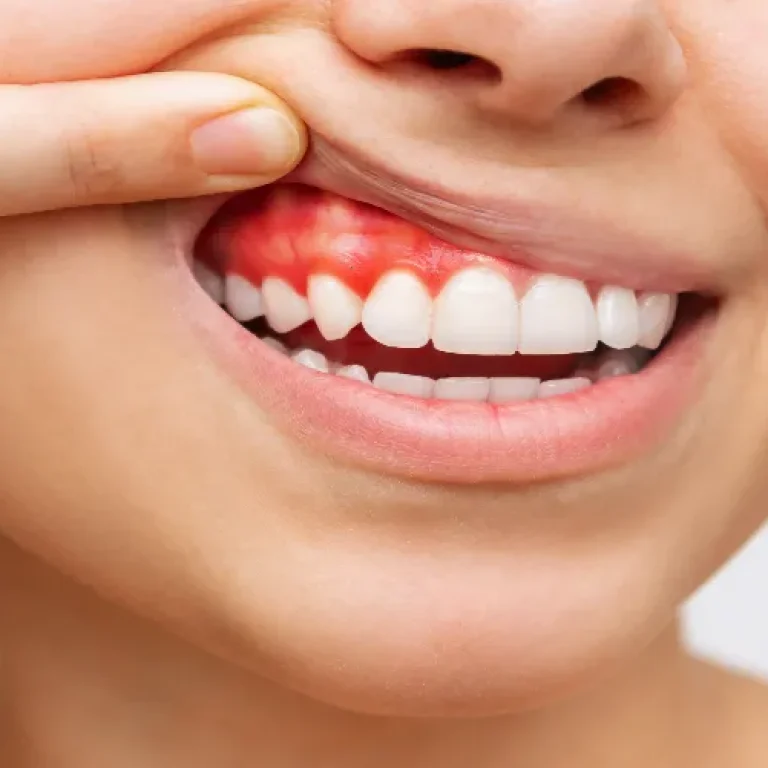 periodontoloji-dis-eti-hastaliklari