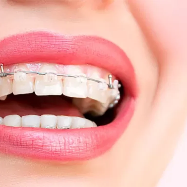 porselen-dis-teli-724x394